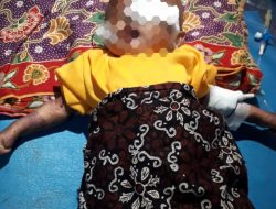 Bayi Usia Enam Bulan Dalam Kondisi Kritis Warga Kecamatan Sukatani Butuh Perhatian Pemkab Bekasi